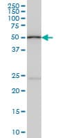 POLE2 Antibody (clone 1A3)
