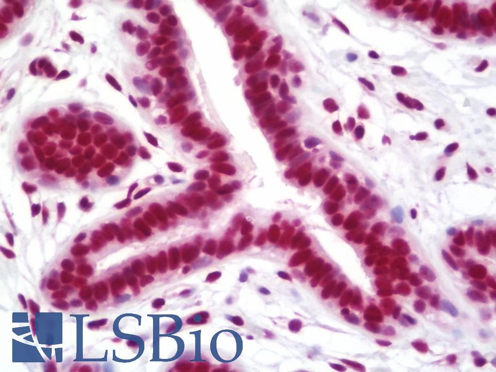 PathPlus™ Polyclonal Rabbit anti-Human SMC1A / SMC1 Antibody (aa1175-C-term, IHC)