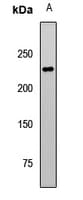 LCX / TET1 Antibody