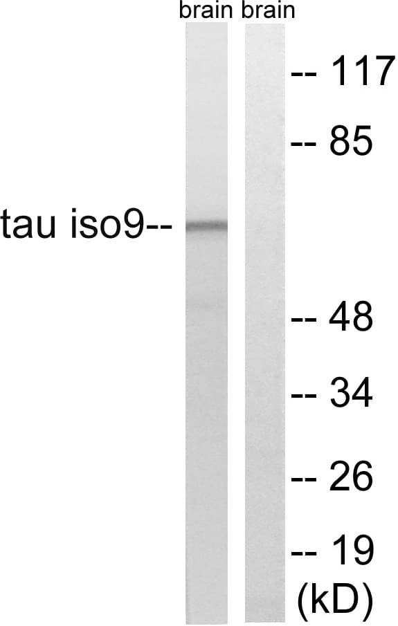 MAPT / Tau Antibody (aa181-230)