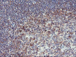 PFKP Antibody (clone OTI1D6)