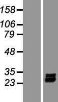 PDGF-AA Protein (Over-Expression Lysate Myc-DDK (Flag))