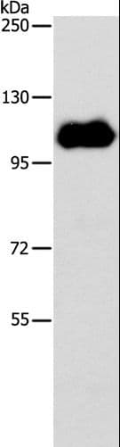 Polyclonal Rabbit anti-Human NOTCH1 Antibody (IHC, WB)