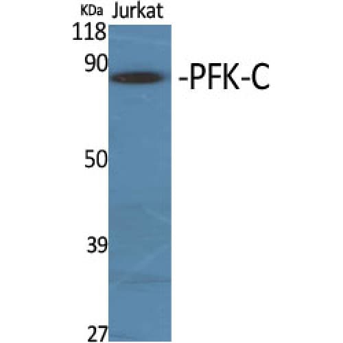 PFKP Antibody (310-390 aa, Internal)