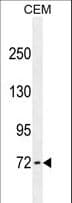 Monoclonal Mouse anti-Human ZFP37 Antibody (WB)