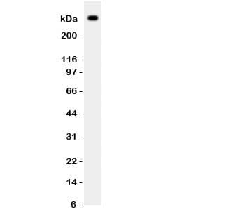 Polyclonal Rabbit anti-Human VWF / Von Willebrand Factor Antibody (aa2535-2813, IHC, WB)
