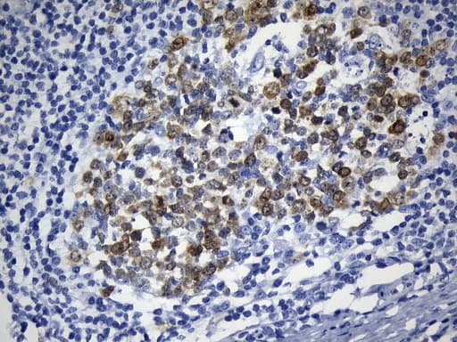 TS / Thymidylate Synthase Antibody (clone UMAB227)