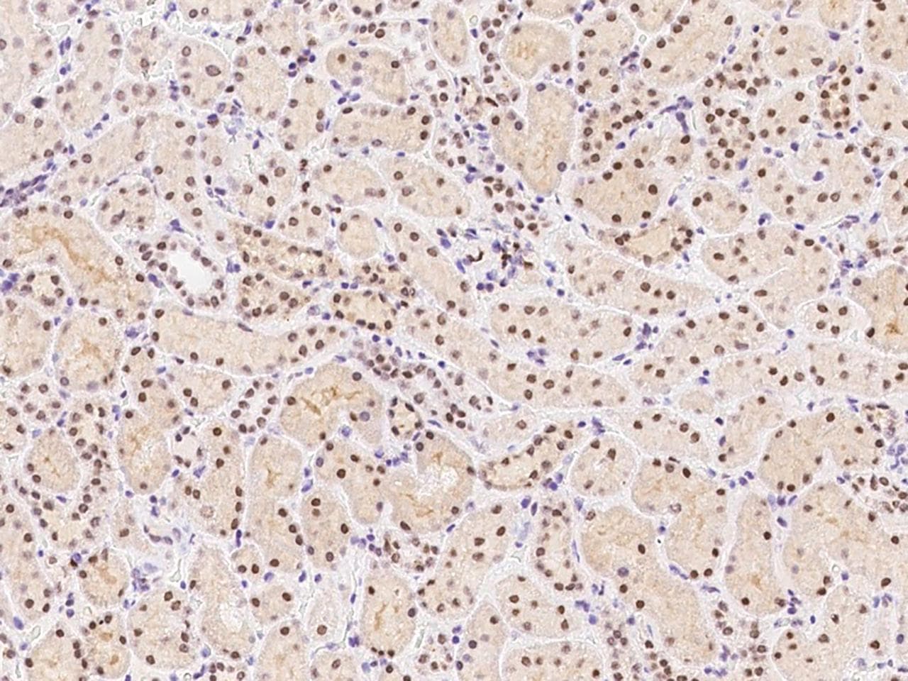 SMARCC1 / SWI3 Antibody (Preservative Free)