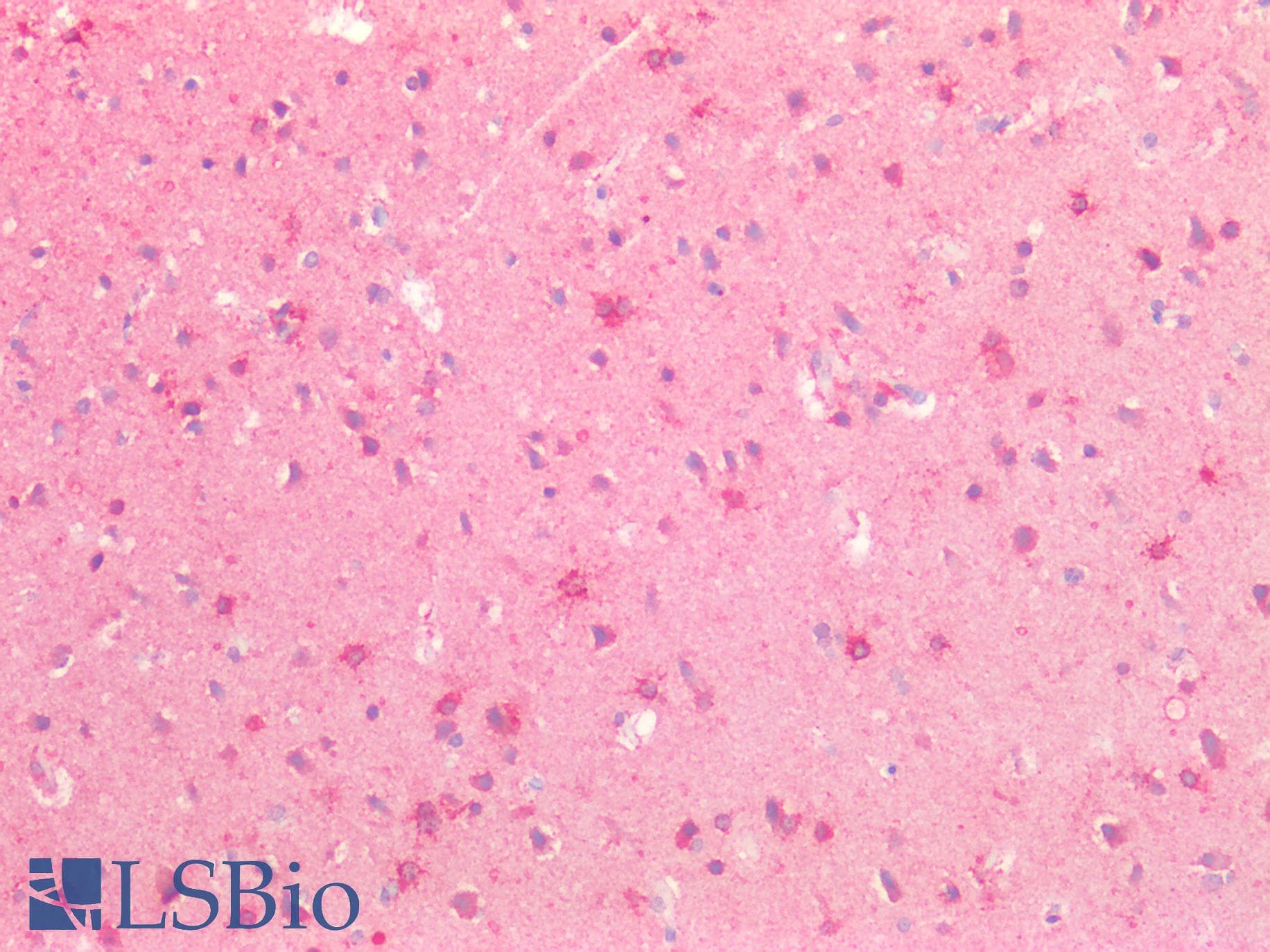 SLIT3 Antibody (aa1405-1512)