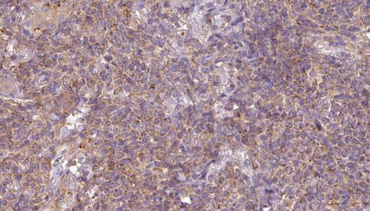 ARL6 Antibody