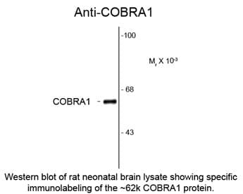 NELFB / COBRA1 Antibody (clone F7E4)