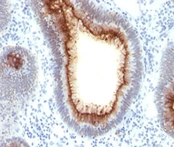Monoclonal Mouse anti-Human CEACAM5 / CD66e Antibody (clone C66/1009, IHC, IF)