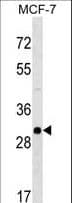 Polyclonal Rabbit anti-Human RAB26 Antibody (aa222-248, WB)