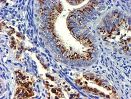 GOLM1 / GP73 / GOLPH2 Antibody (clone OTI5F4)