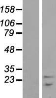 Human SNRPB / COD Protein (Over-Expression Lysate Myc-DDK (Flag))
