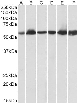 PathPlus™ HSPD1 / HSP60 Antibody