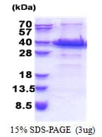 Human ACBD6 Protein (Recombinant His)