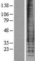 SDC2 / Syndecan 2 Protein (Over-Expression Lysate Myc-DDK (Flag))