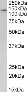 Polyclonal Goat anti-Human PTCH1 / Patched 1 Antibody (aa266-280, IF, WB)