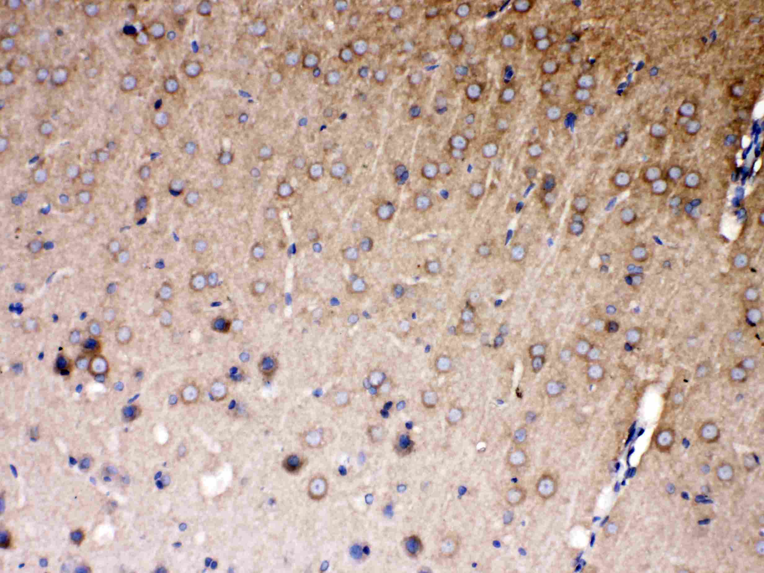 Polyclonal Rabbit anti-Human PAPD7 / TRF4-1 Antibody (IHC, WB)