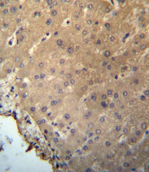 CHMP2B Antibody (aa1-30)