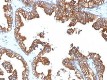Cytokeratin 8+18 Antibody (clone 5D3)