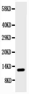 TFF1 / pS2 Antibody (aa59-72)