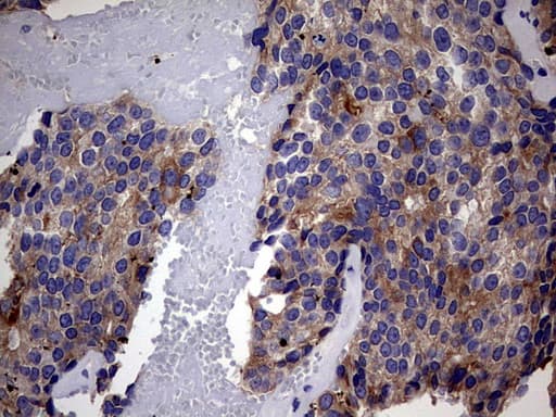 IRAK2 / IRAK-2 Antibody (aa362-625, clone OTI4C1)