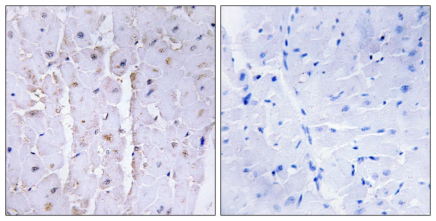 Polyclonal Rabbit anti-Human LBC / AKAP13 Antibody (IHC, WB)