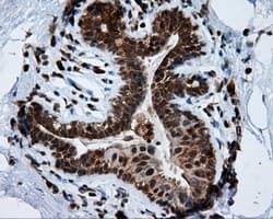 TPMT Antibody (clone OTI2A2)