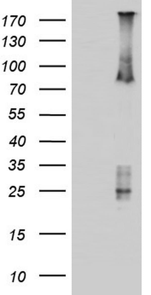 ARAF / ARAF1 / A-RAF Antibody (aa145-365, clone OTI2G4)