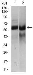 Monoclonal Mouse anti-Human HAS2 Antibody (clone 40000000, Amino Acid: 67-170, IHC, IF, WB)