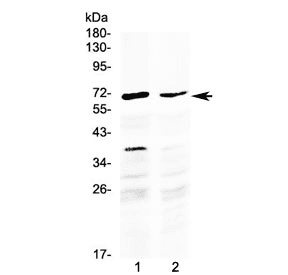 MAK Antibody