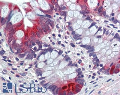 IHC-plus™ GUCA2A / Guanylin Antibody