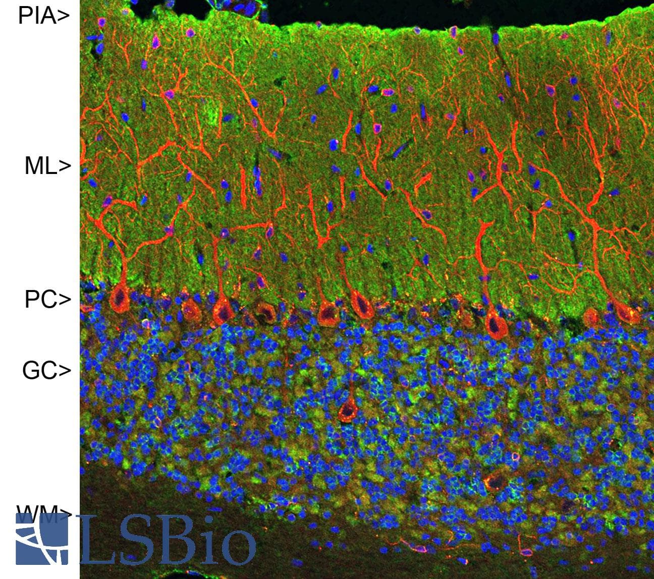 IHC-plus™ Monoclonal Mouse anti-Human VILIP / VSNL1 Antibody (clone 2D11, IHC, IF, WB)