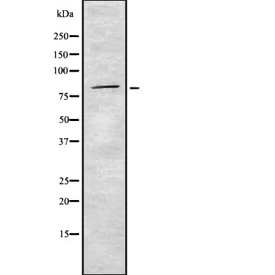 Mitofusin 2 / MFN2 Antibody