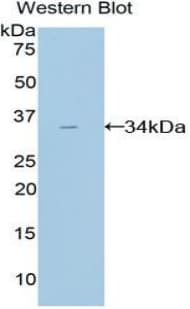 AMY2A / Pancreatic Amylase Antibody (aa201-473)