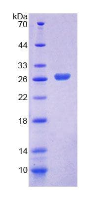 Mouse ITGA3 / CD49c Protein (Recombinant His-T7)