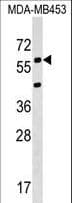 Polyclonal Rabbit anti-Human KCNS3 Antibody (aa1-30, WB)