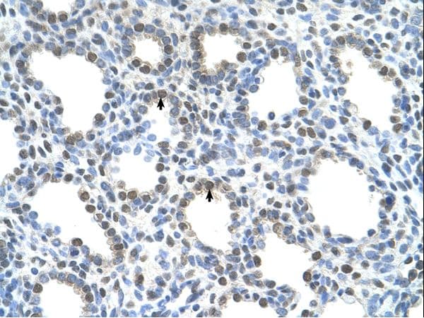 SLC15A4 / PHT1 Antibody (N-Terminus, HRP)