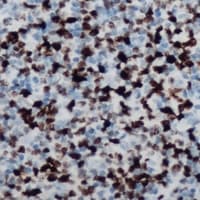 Polyclonal Rabbit anti-Human MSX2 / MSH Antibody (IHC, WB)