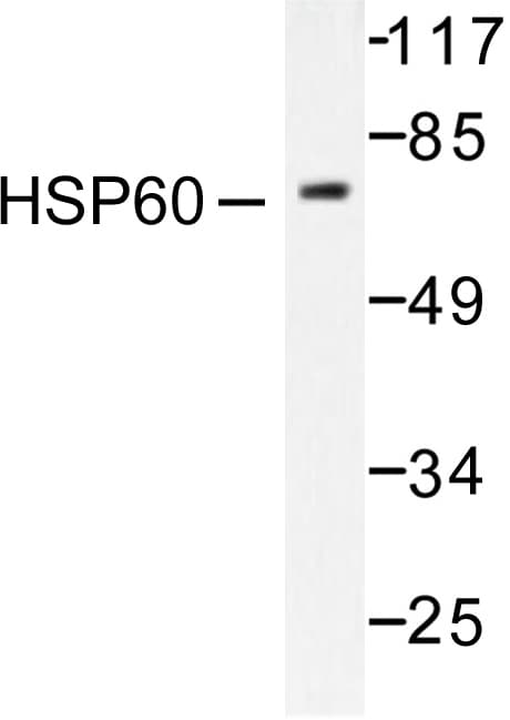 HSPD1 / HSP60 Antibody (Thr547)