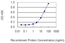 Monoclonal Mouse anti-Human PPP4C Antibody (clone 1E8, WB)