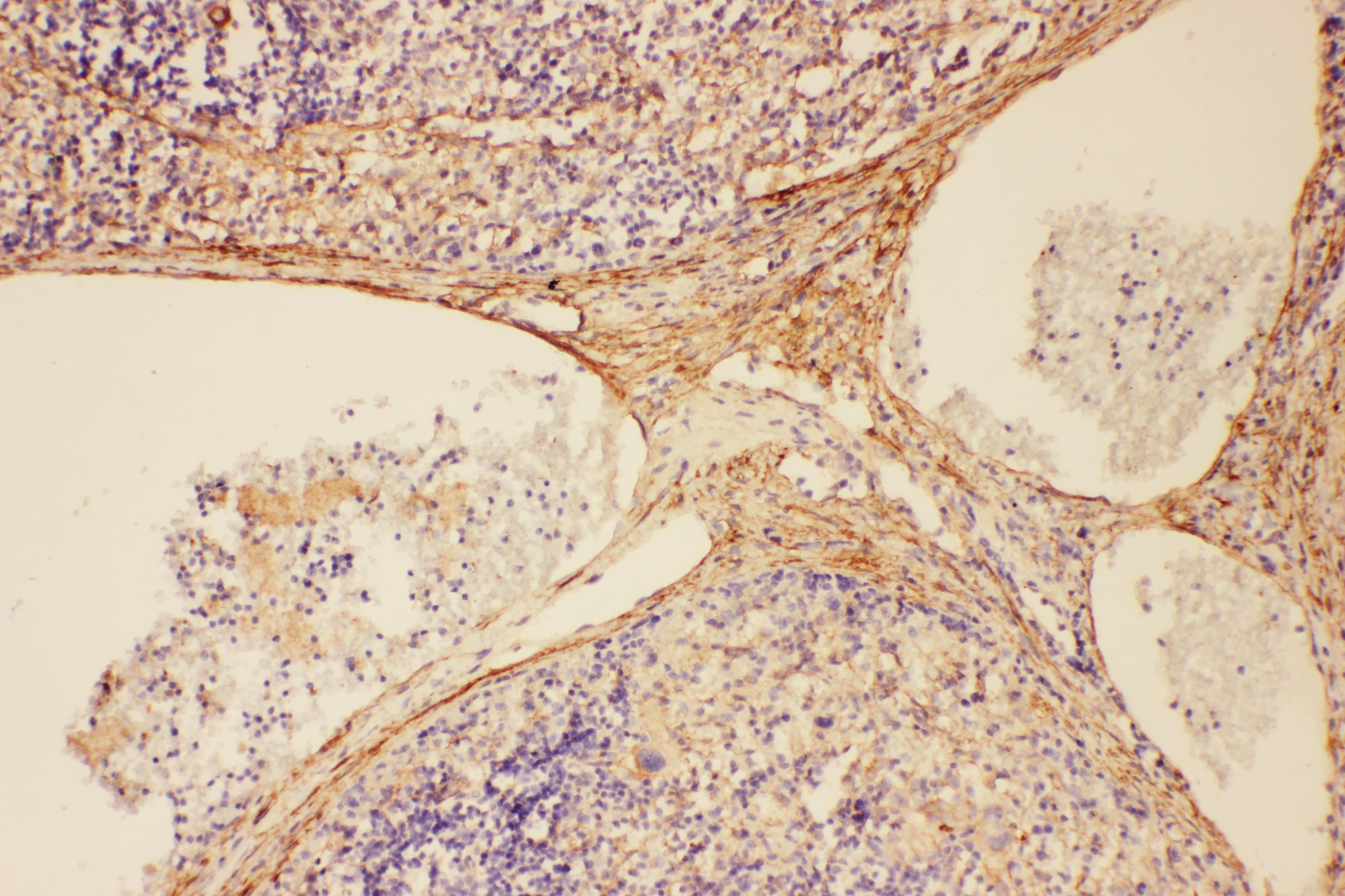 Complement C5 Antibody (aa1-18)