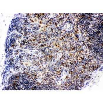 Polyclonal Rabbit anti-Human CTBP1 / CTBP Antibody (aa409-440, IHC, WB)