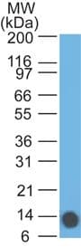 Monoclonal Mouse anti-Human EPS8 Antibody (clone 18F1F2, aa701-882, IHC, WB)