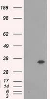 Monoclonal Mouse anti-Human AKR1A1 Antibody (clone OTI3C7, IHC, WB)