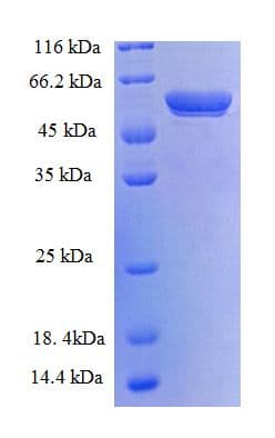 Human YWHAH / 14-3-3 Eta Protein (Recombinant GST)