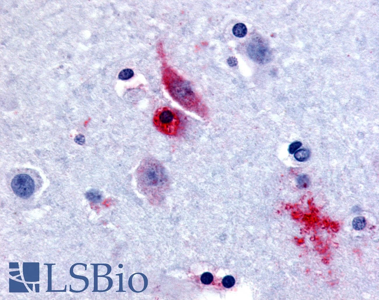 IHC-plus™ GPR61 Antibody (Extracellular Domain)