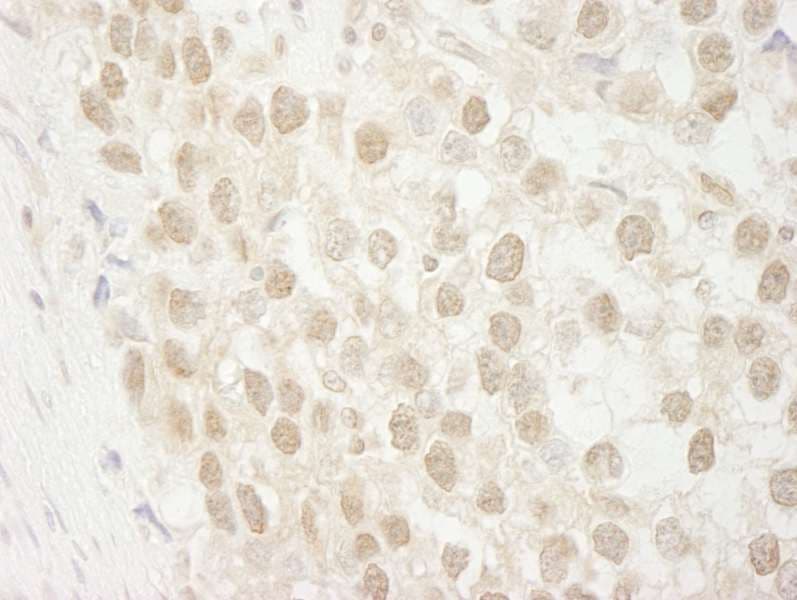 MTA3 Antibody (aa400-450)